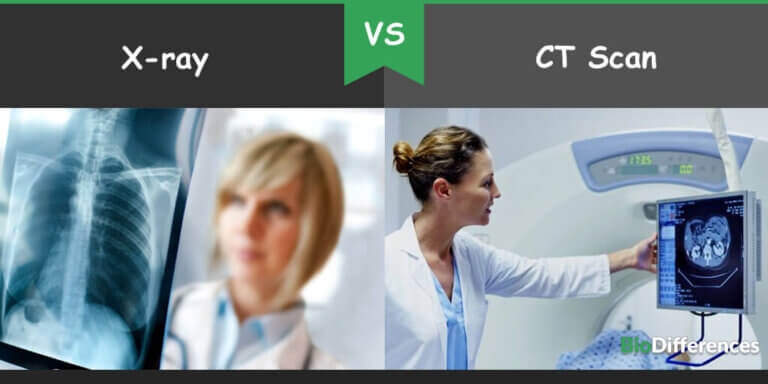 Difference Between X-ray and CT Scan – Bio Differences